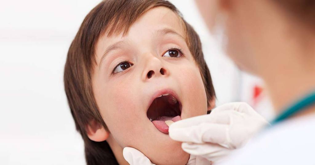 Amigdalectomia em crianças_ Riscos e Benefícios