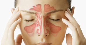 Benefícios da sinusectomia para tratar sinusite crônica