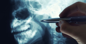 Tratamentos eficazes para adenoides grandes